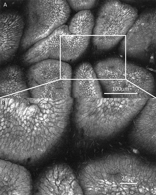 11. 胃腸道微生物成像.jpg