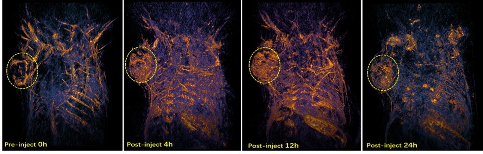 生物納米探針腫瘤成像.jpg