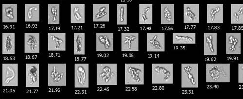 生物制藥研發(fā)-蛋白質(zhì)聚集體.jpg